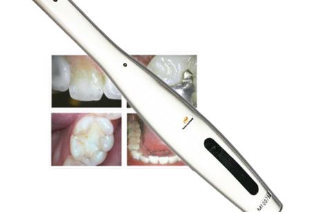 CÁMARA-INTRAORAL